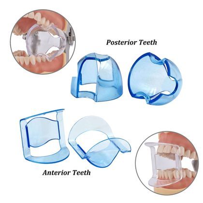 Dental Anterior And Posterior Teeth Opener Support Orthodontic Opener Plastic Opener Occlusal Pad Mouth Opener