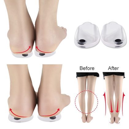 2PCS Insoles Correction Shoe Inserts Pads Effective O/X Type Leg Bowed Legs Knee Valgum Straightening for Women Men Health Care
