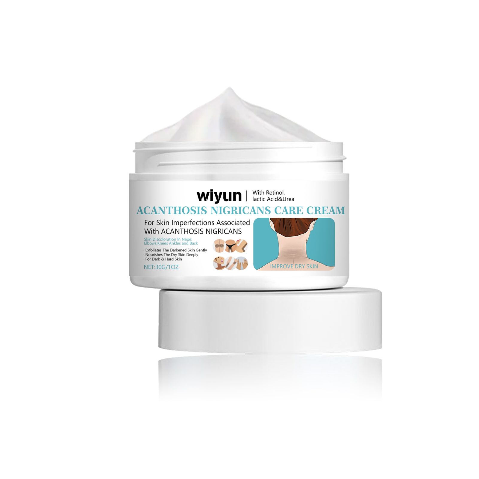 Wiyun Acanthoderma Nigricans Care Cream Soft Moist, Hydrating, Refreshing And Improving Dry And Tender Skin Body Care Cream